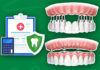 Does Dental Insurance Cover Crowns