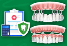 Does Dental Insurance Cover Crowns