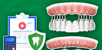 Does Dental Insurance Cover Crowns