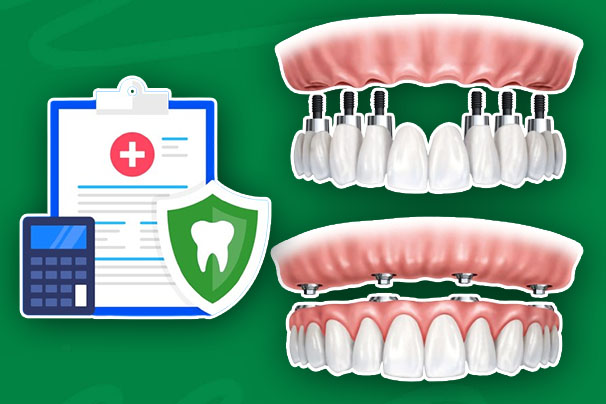 Does Dental Insurance Cover Crowns