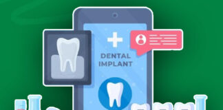 How To Get Dental Implants Covered By Insurance